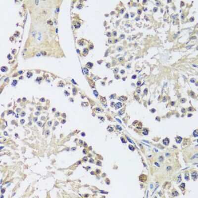 Immunohistochemistry-Paraffin: MYG1 Antibody - Azide and BSA Free [NBP3-03741]